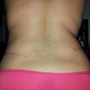 6 weeks P/O back