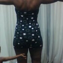 This is the back view showing the shape before surgery.