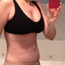 4 weeks post op