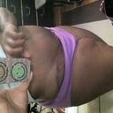 My Scar is healing nicely!