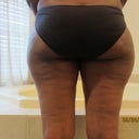 I have broad hips...genetics, that I cannot change lol