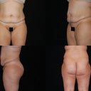 "Before" pics