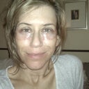 The Day of Surgery (about 10 hours after)