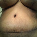 14 days post still swollen