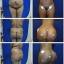Dr.Jimersons amazing work ..