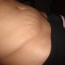 laying down the bulge does not sink in