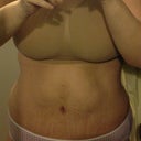 Day 18 still swollen