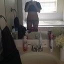 1 year post op