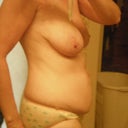 pre op