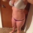 Before going into surgery - 170 pounds