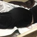 Post Op - Taken immediately after surgery