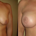 boobies