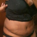 Side View- Wk2- Still swollen