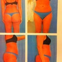 5 weeks post op