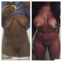 Surgery date vs. Today (3 weeks post op)