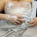 A few hours out of surgery
