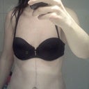 9 weeks facing - scar is pretty low