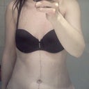 9 weeks facing showing scar