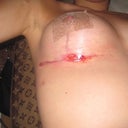 right side not doing so well