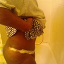 day 2 I like the new tummy I don't like how he put the surgical tape on its in patches:( not pleased about that.
