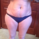 Before pic