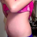 BEFORE ANY TUMMY TUCK. (SIDE)