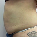 tummy side before