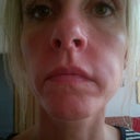 hamster cheeks