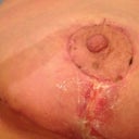 Worried black spot is pink