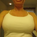 Two Weeks Post Op