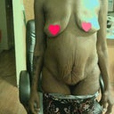 After losing 150 Pounds
