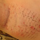 Right side