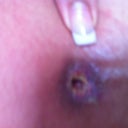 what is left of my belly button