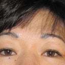 Before the surgery