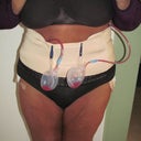 24 hours post op