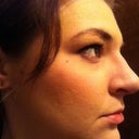 Hmm bump from swelling? I hope so. :/