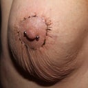 17days. More loose skin.
