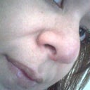 still swollen, but I can see the changes