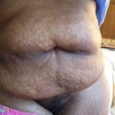 This is my stomach on week pre op.