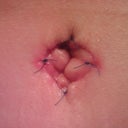bb @ 3 weeks po. I think it looks awesome! can't wait to get those last few stitches out.