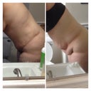 Leaning over before/after.