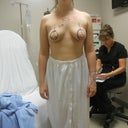 pre op markings