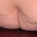 Here is when I sit, especially on a hard surface, seems like the fat inserted on the top gives that weird shape