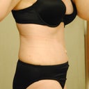 12 days post po. This is kind of angled a bit.