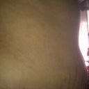 18-dpo Side view, you can see the swelling in the lower abdomen  :'(