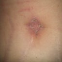 18-dpo BB looking good