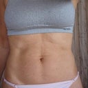 PRE: Day 4; Anterior Tight