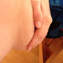 Trying to imagine how my skin will retract, wrinkly, not sure there's much elasticity to my skin :/