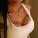 1 month post op revision 8/2011