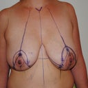 All Marked Up